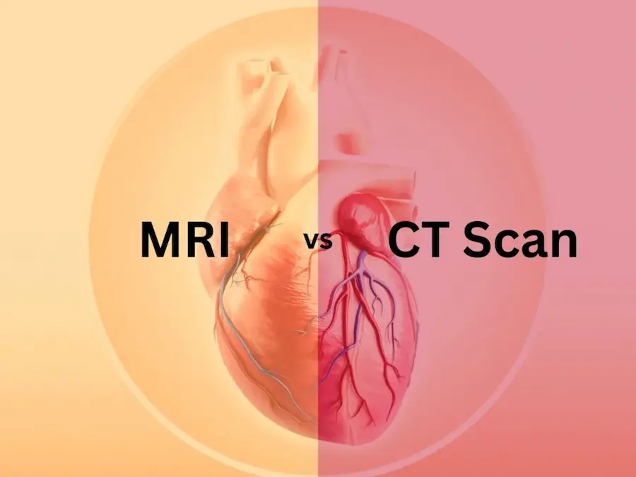 MRI vs CT Scan comparison - Understanding the difference between magnetic and X-ray imaging